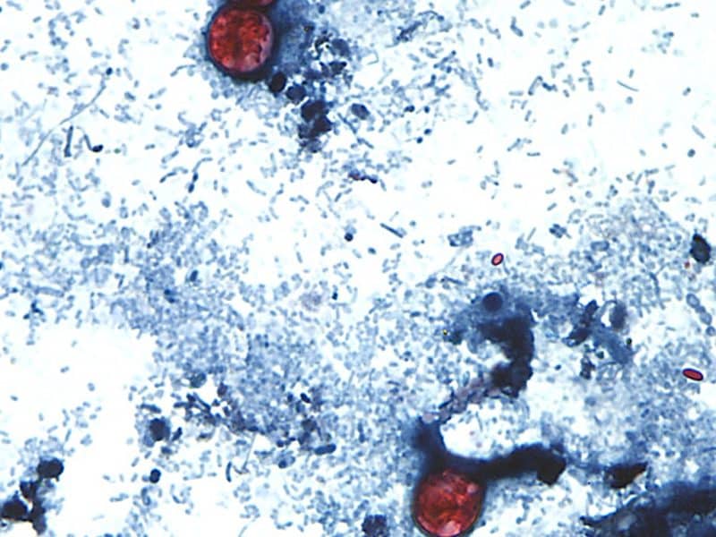 Outbreak of diarrhea-causing parasite grows to more than 1,000 cases nationwide, Ohio cases ticking up